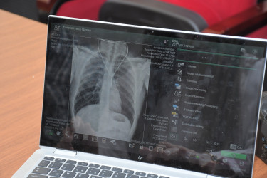 Sabunçu rayonunda səyyar rentgen müayinəsi aksiyası keçirildi.